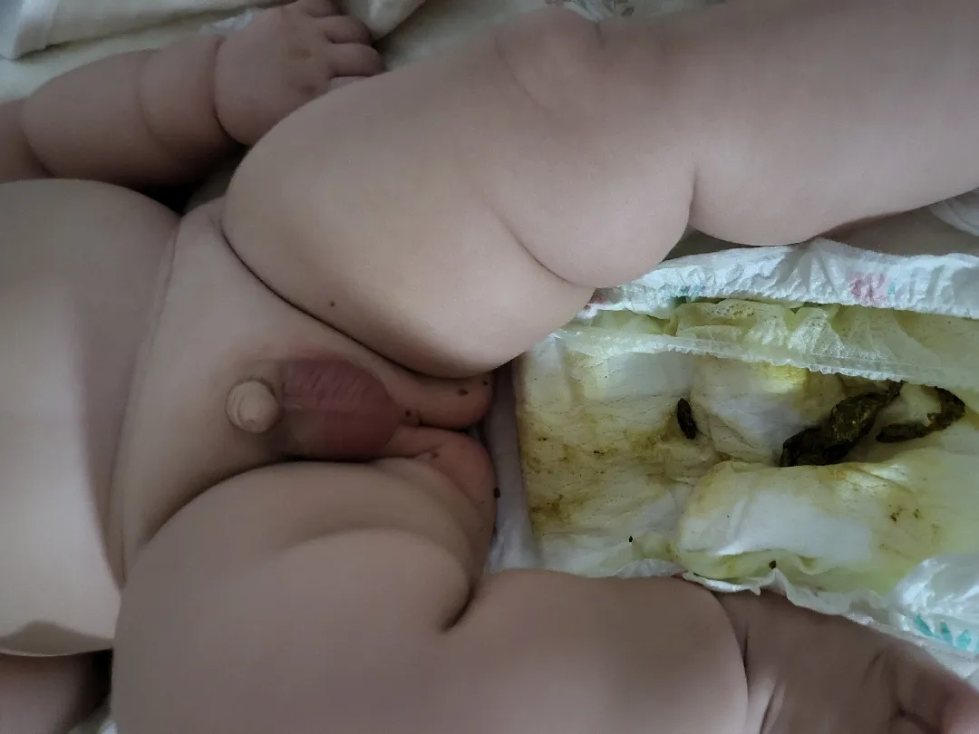 아기 감기,변(응가사진있으니 참고해주세요)