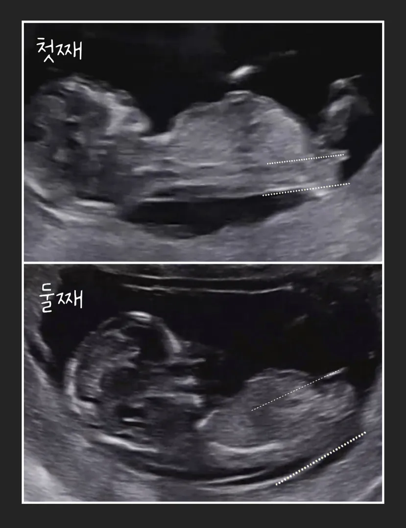 딸 각도법 사진보고 참고하세요^^