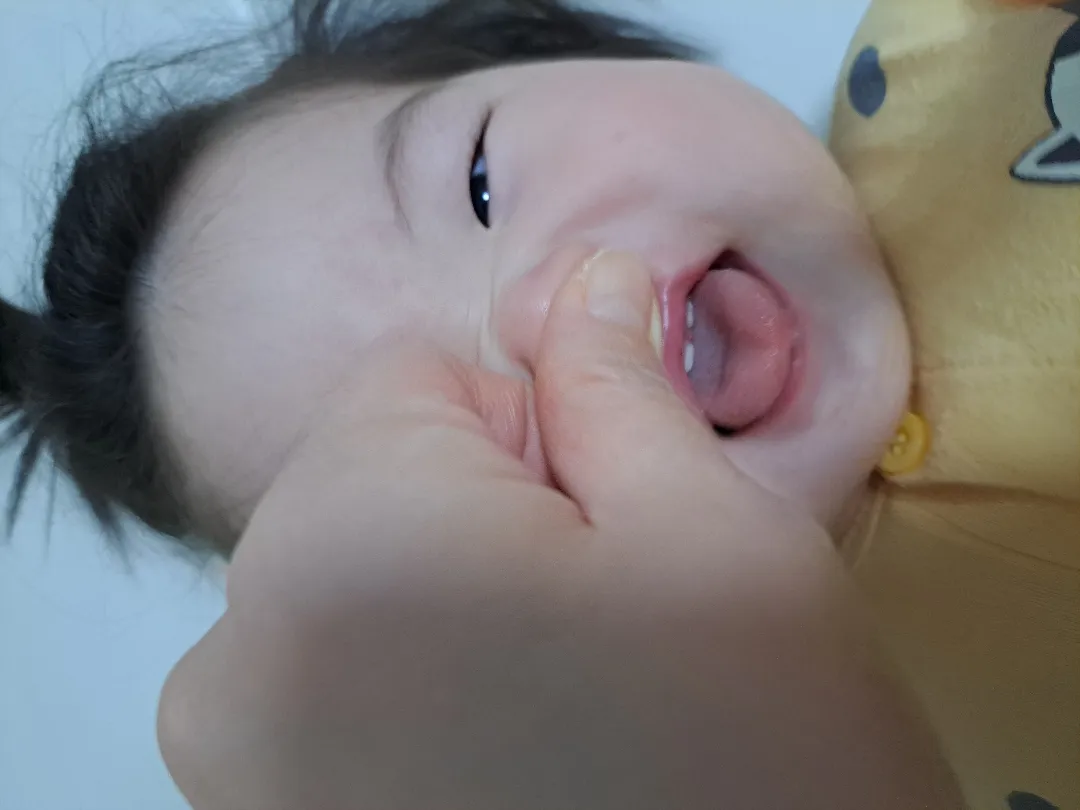 윗니좀 봐주세요~