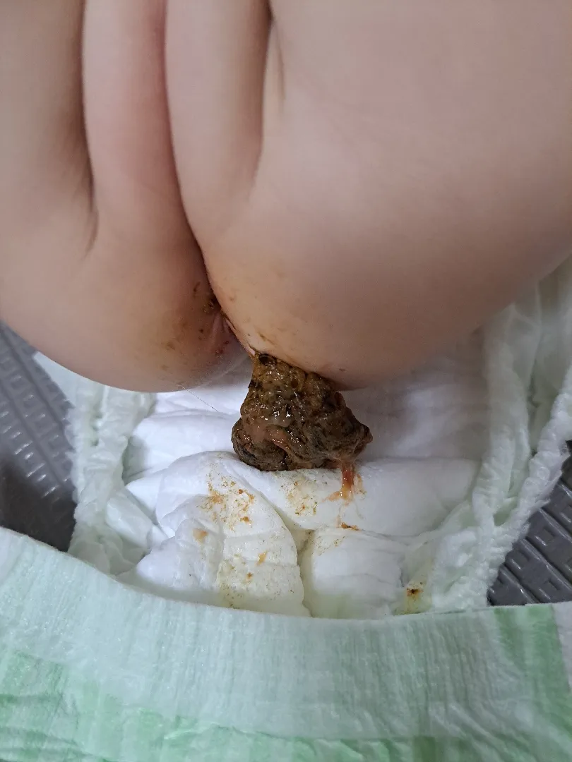 응아사진(더러움주의)