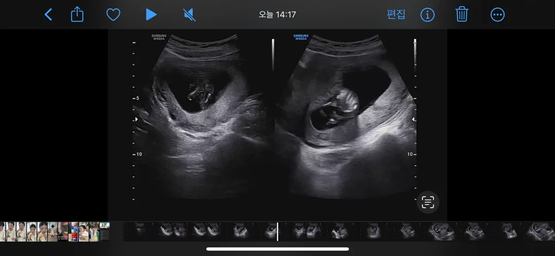 각도법 고수님들 도와주세여🙏🏻🥲