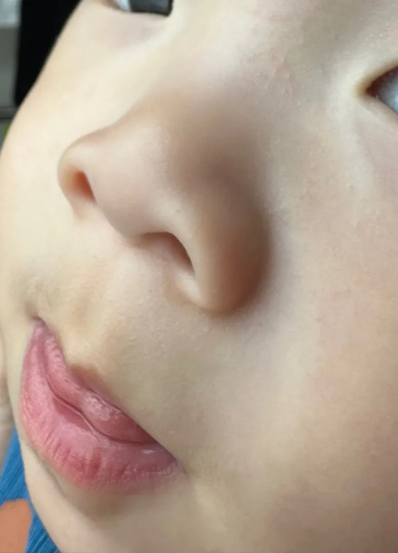 아기 얼굴에 뭔가가 올라왔는데 어떻게 해야할까요?