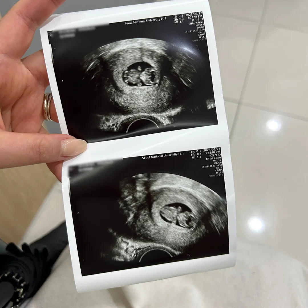 태아보험도 끝냈고 9주를 향해 달려가는 젤리곰 보고왔어용!