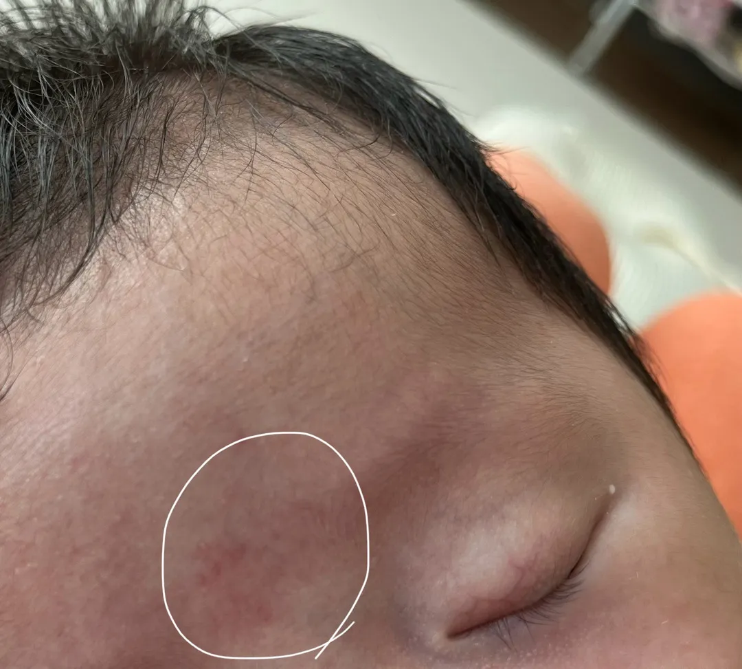 아기 피부봐주세용