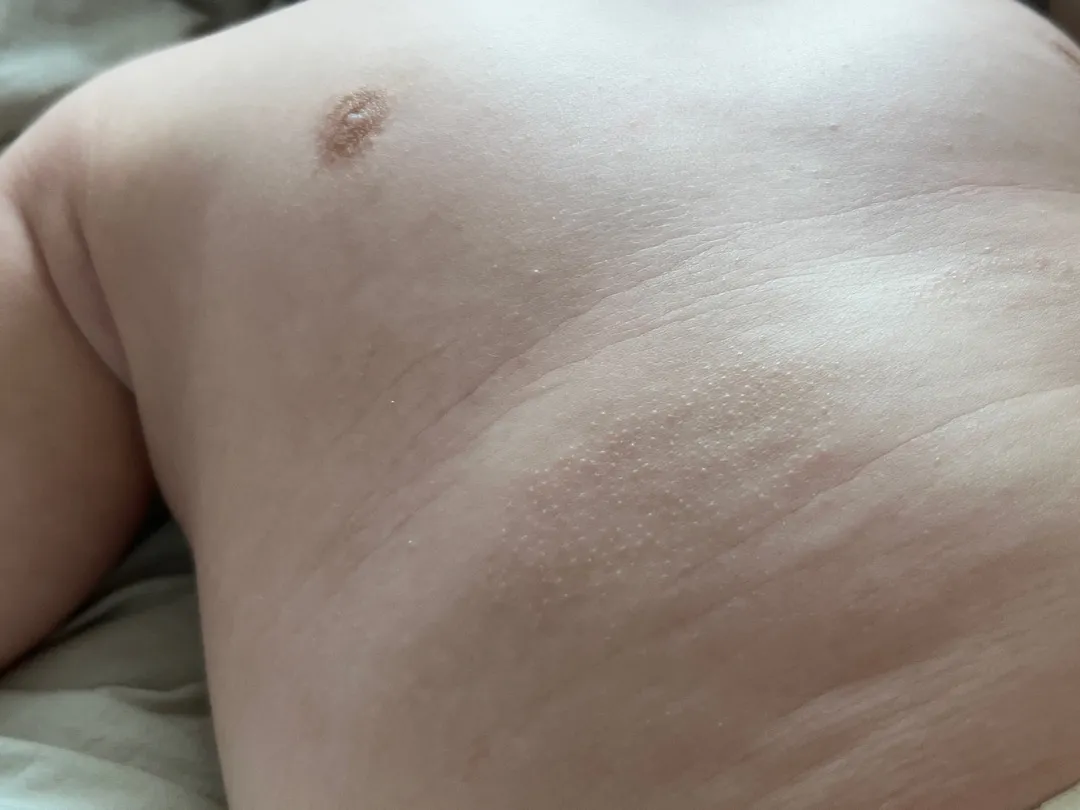 피부 봐주세요 ㅠㅠ
