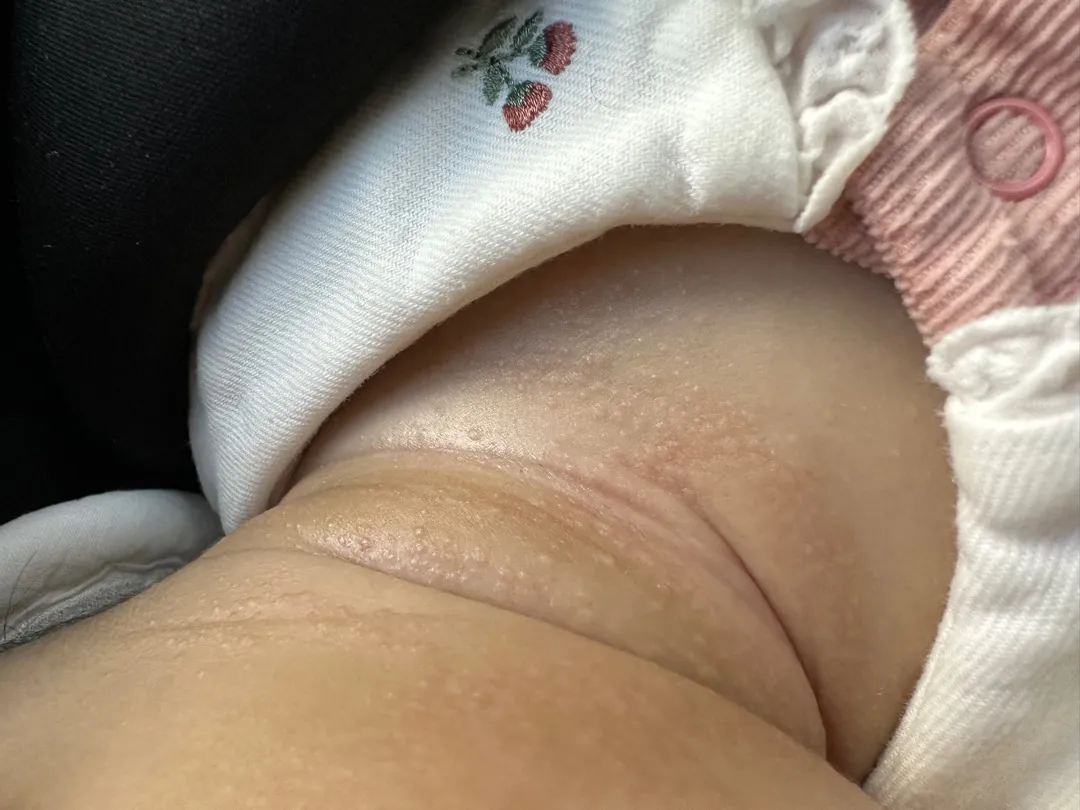피부 무슨 일일까요 속상해요ㅠㅠ