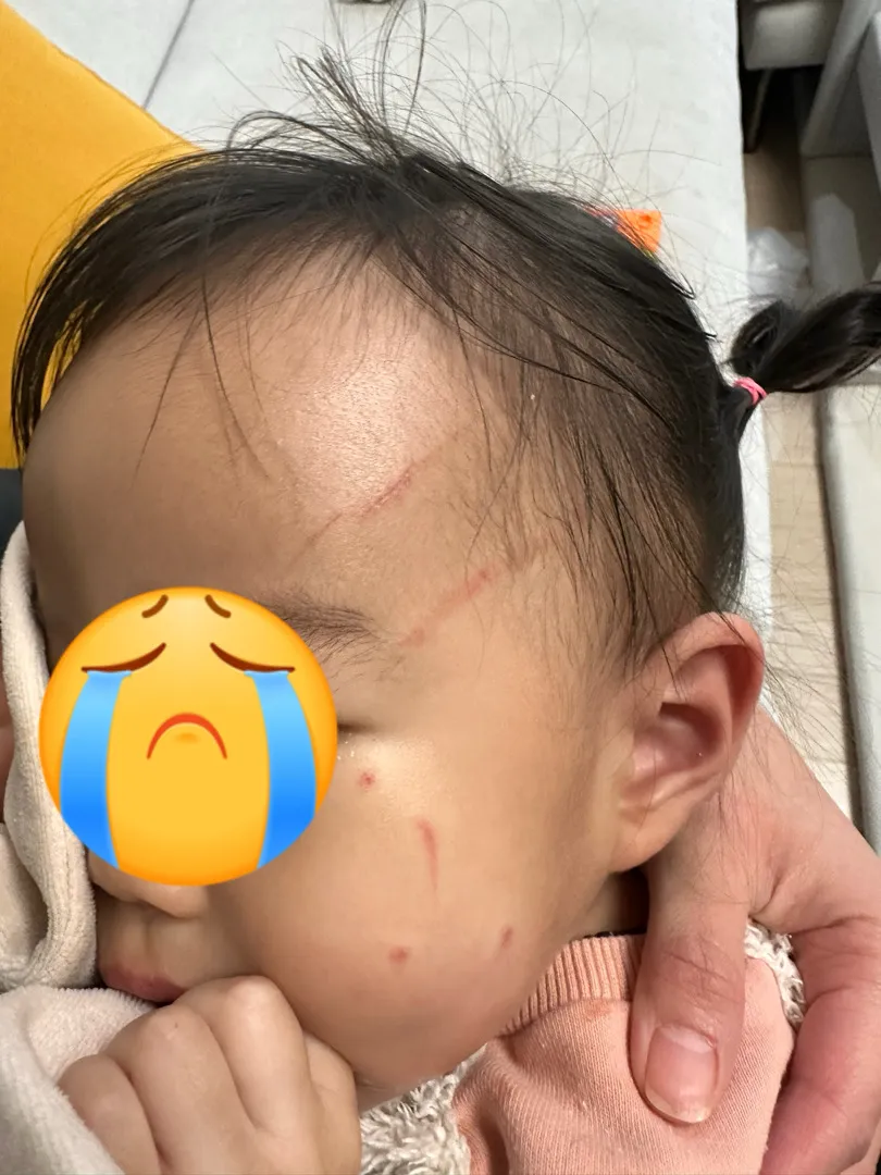 어린이집 안전사고 조언