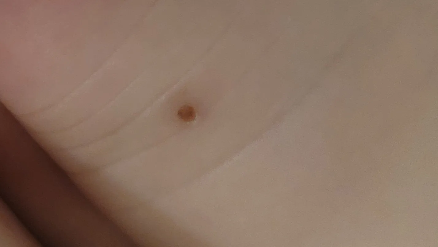 빈대 물린거 아니겠죠..?