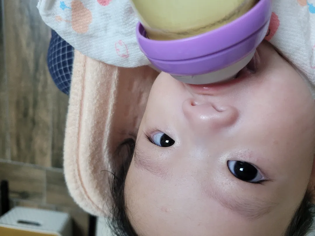 눈주변 좁쌀여드름 