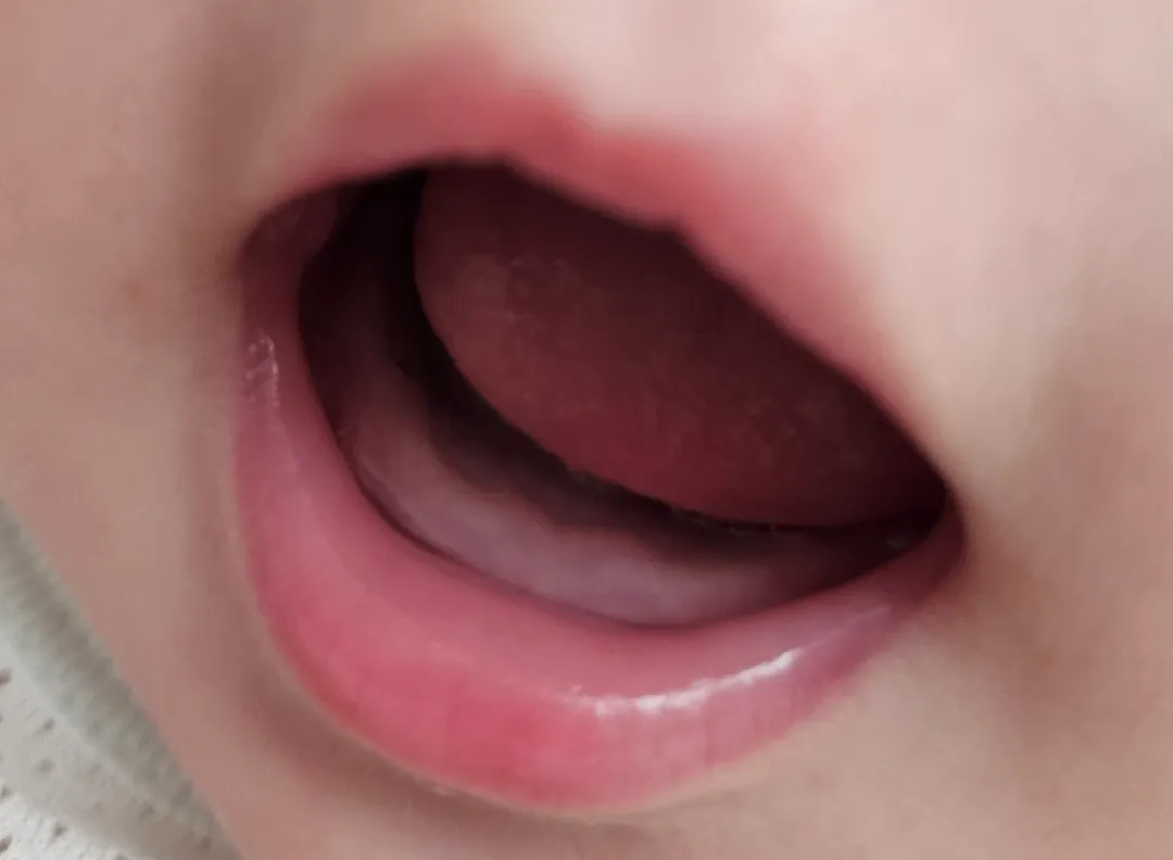 혹시 이앓이하면 수유하다 짜증내나요?🥲