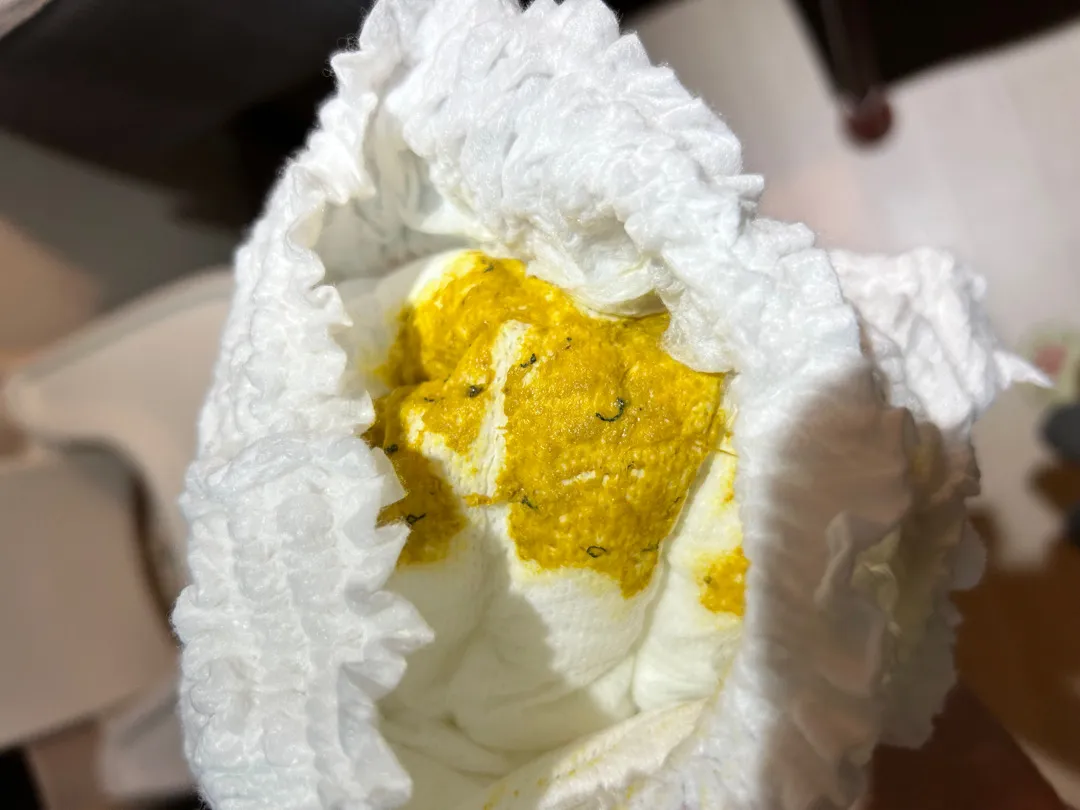 (사진 주의)아기똥에 검정 실?같은거가있어요