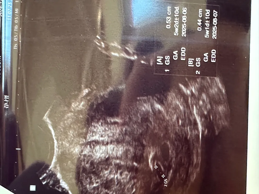 두개가 맞을까요?
