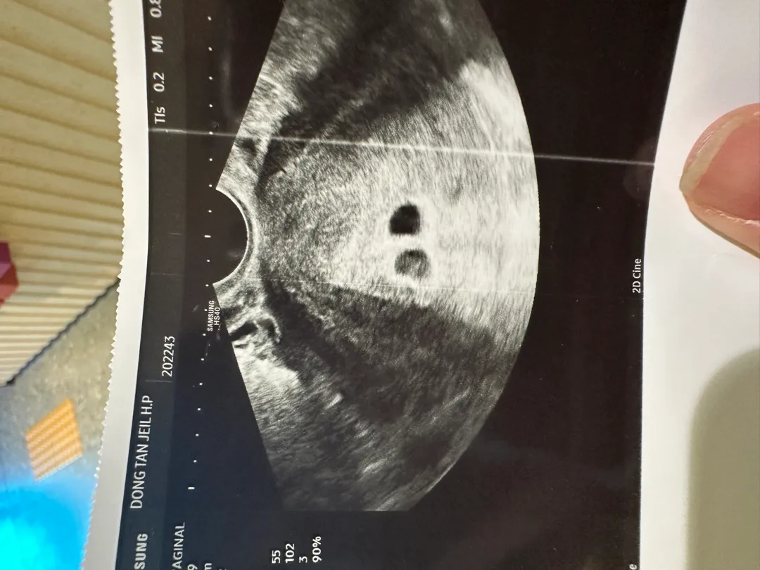 아기집봤어요