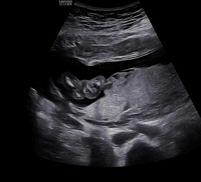 16주 3일 성별 나왔어요~