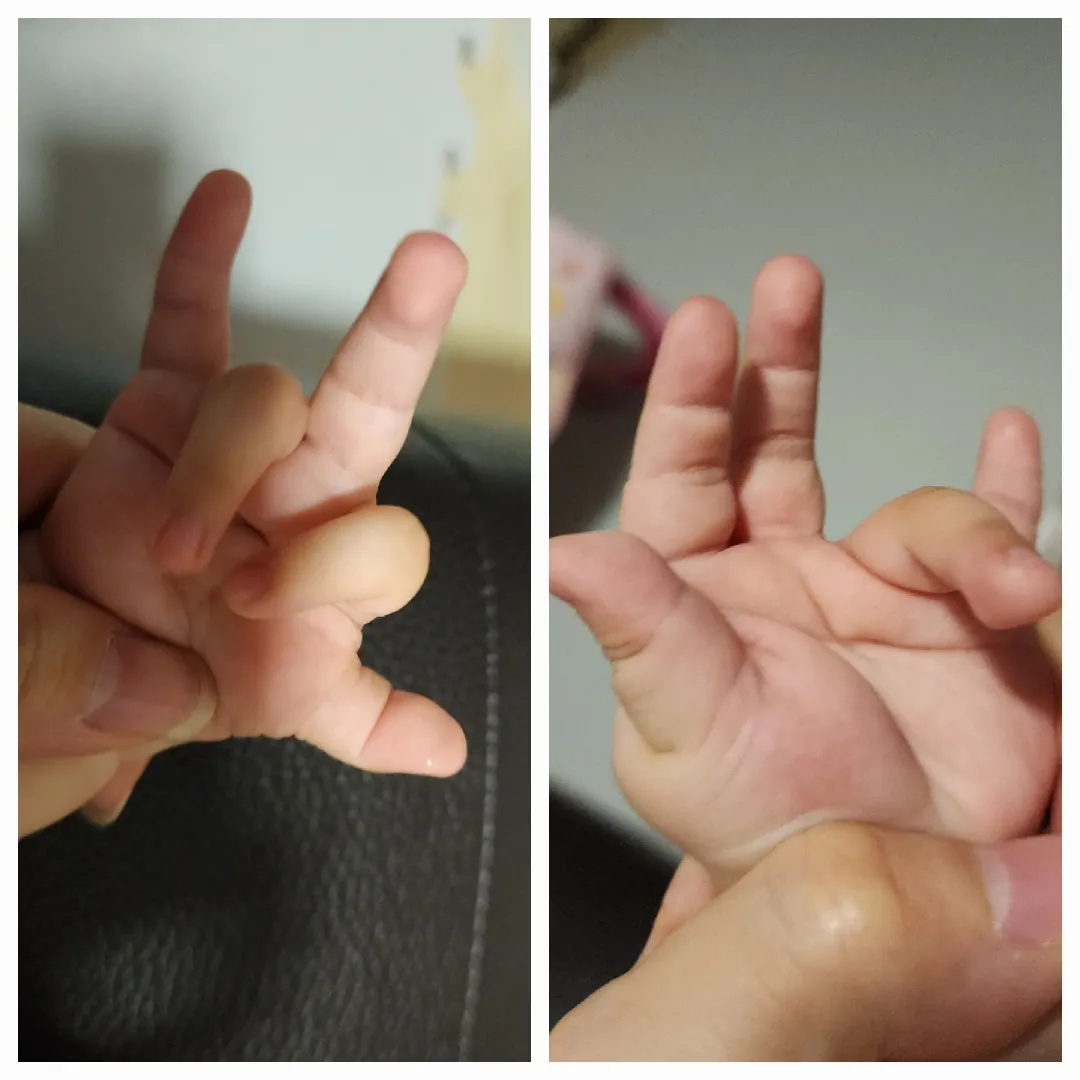 손가락 다 안 펴는 아기
