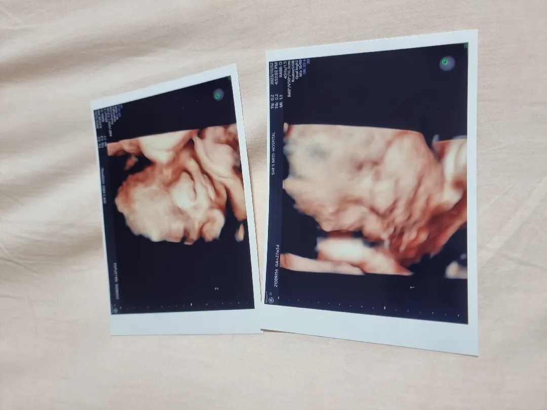 둥이 입초 찍었어여!!!(ง˙∇˙)ว