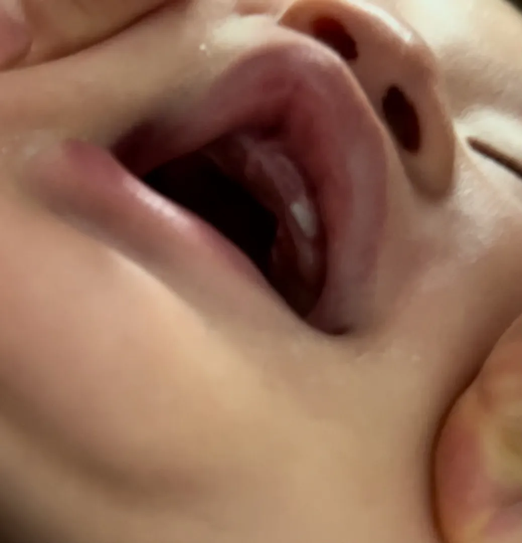 앞니보다 옆니가 먼저 난 아가들 있나요