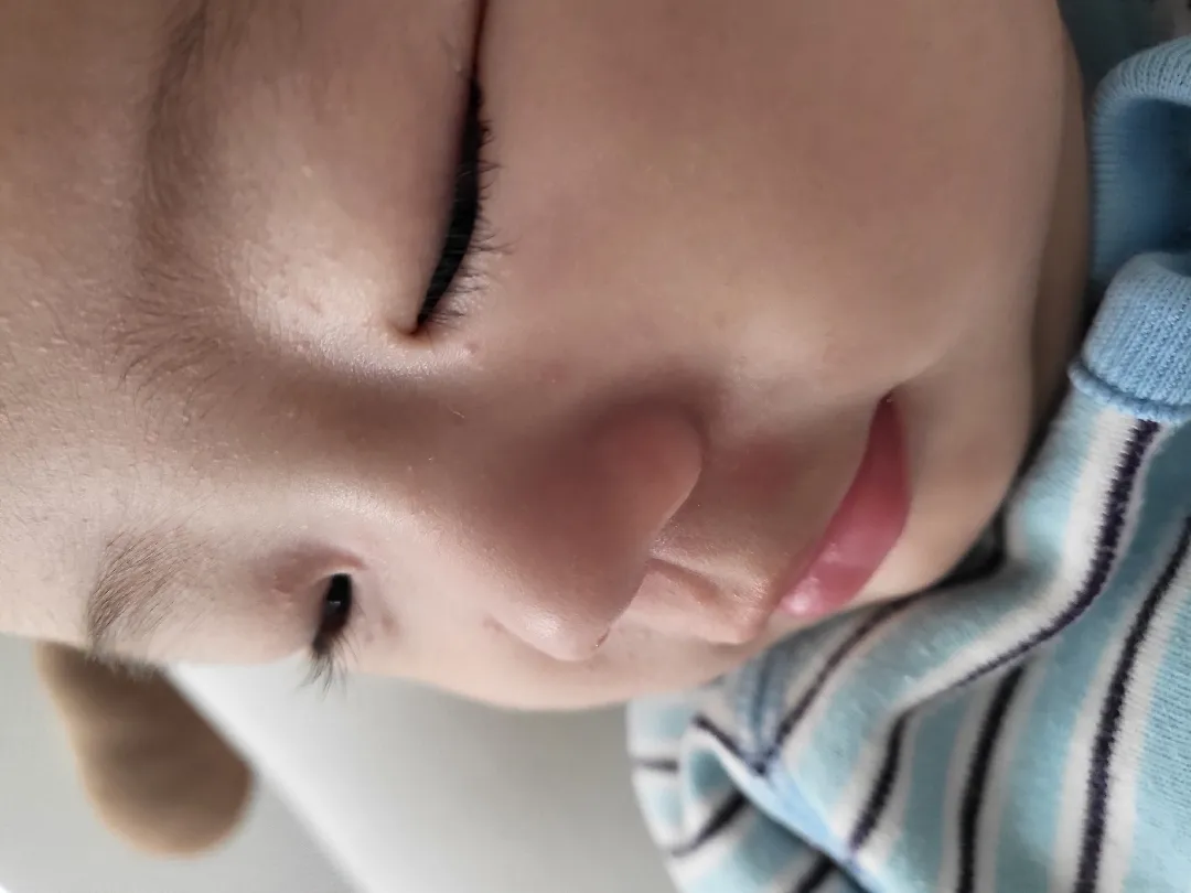 피부에 오돌토돌 뭘까요?우째야하나요 ㅠㅠ
