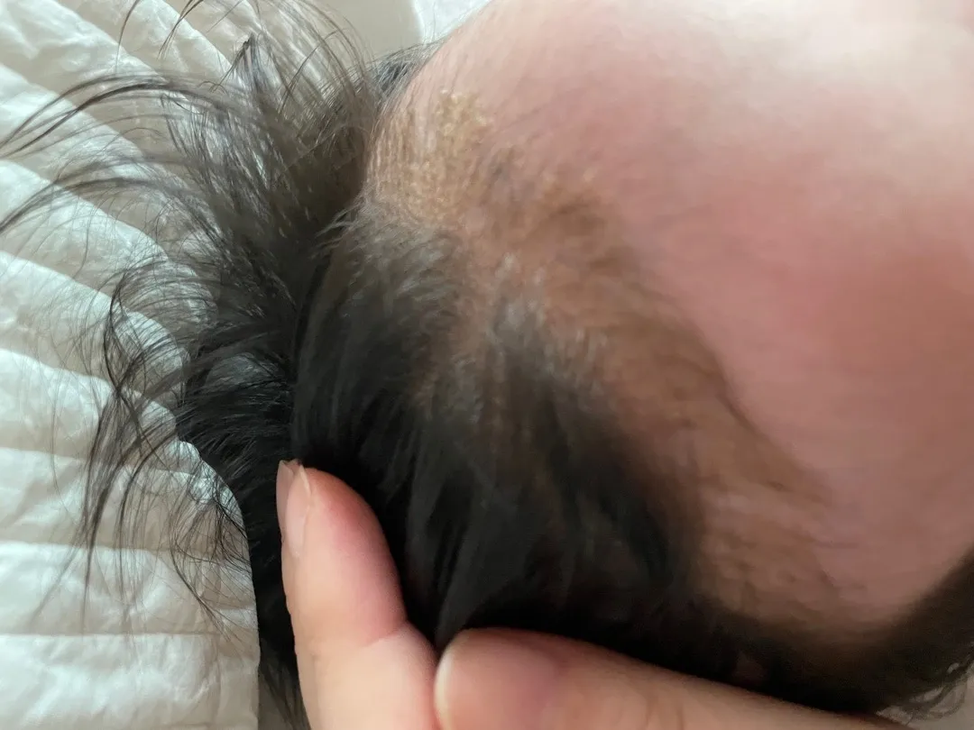 아직도태지잇는아가잇나요?