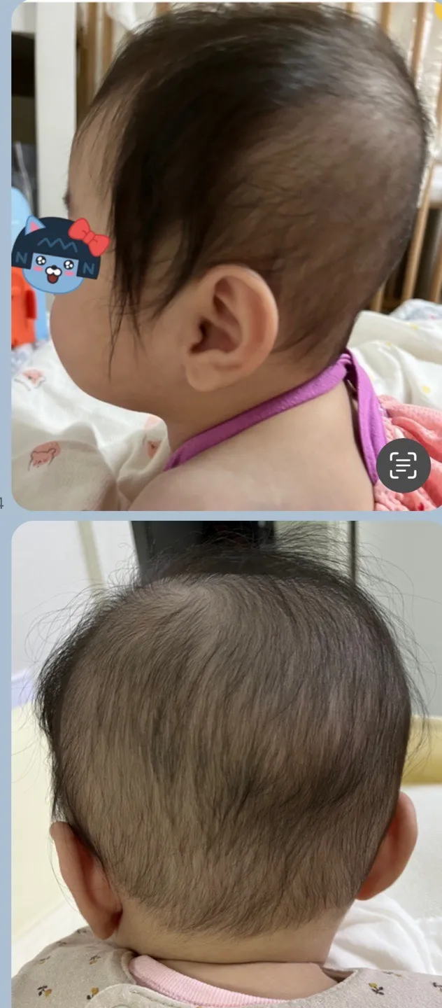 뒤통수 .. 하니헬멧 상담하고 왔습니다