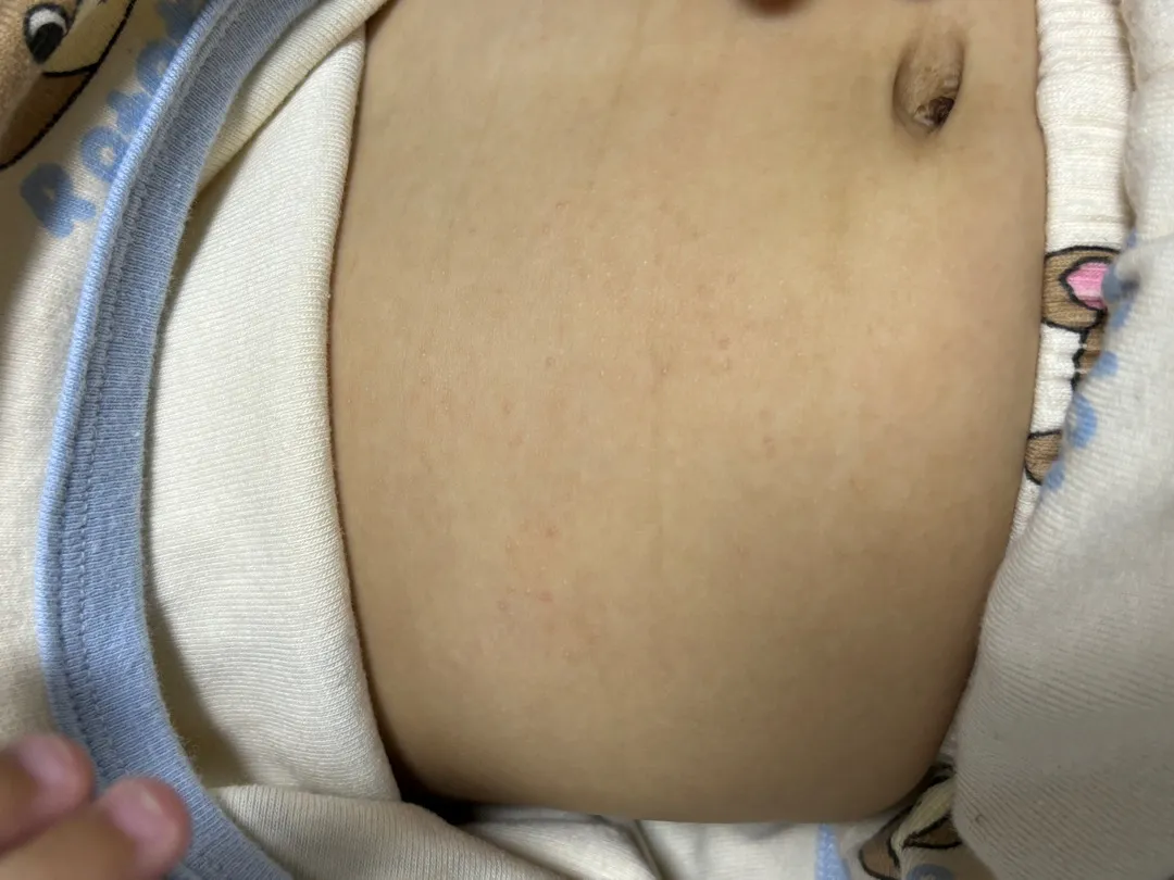 아기 피부 좀 봐주세요!!!