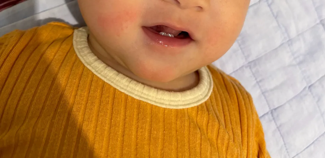 침독일까요? ㅠㅠ