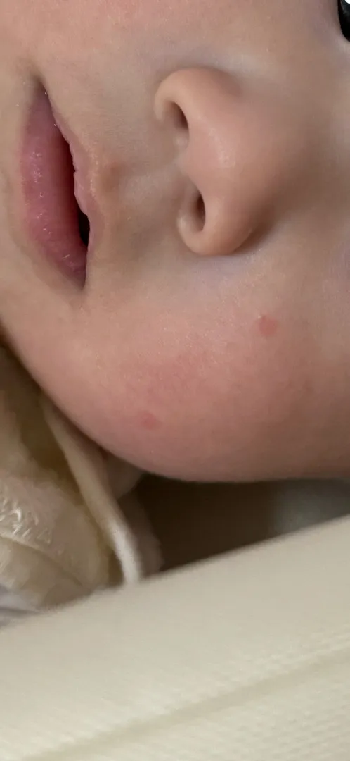 아침에 아기 피부가 