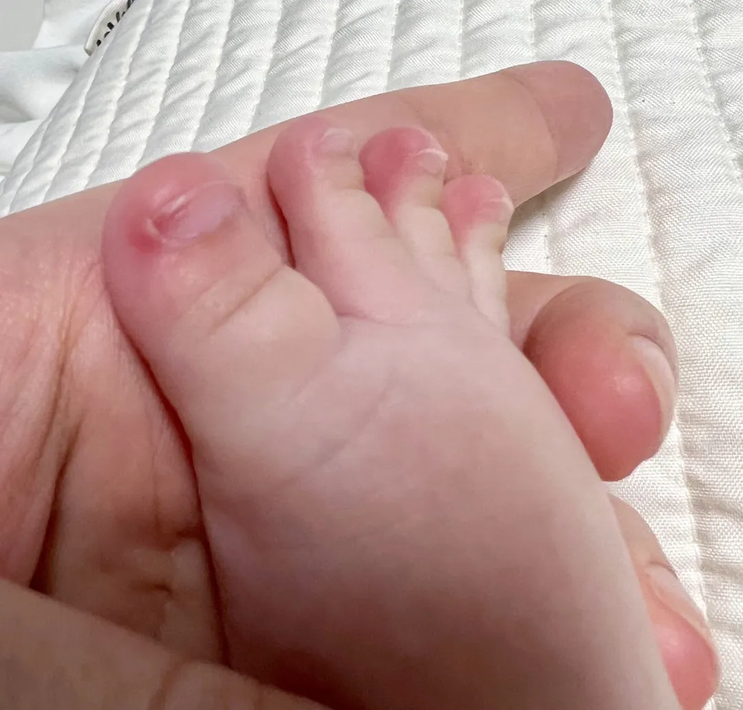 아기발좀봐주세요ㅠㅠ