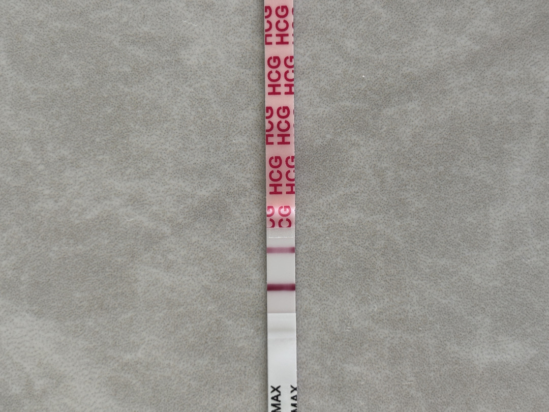 역전 아기집보일까요?