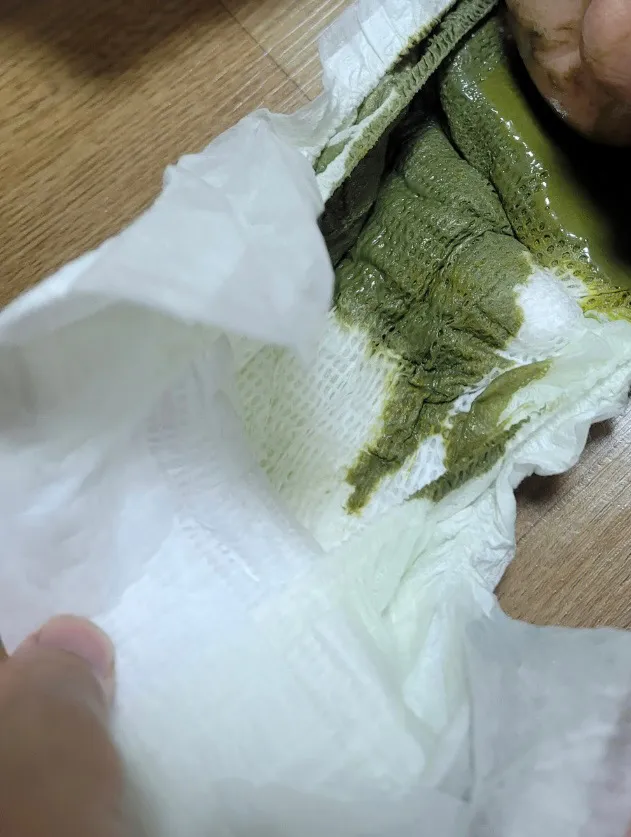 3개월아기 정상변인지 좀 봐주세요 사진있습니다