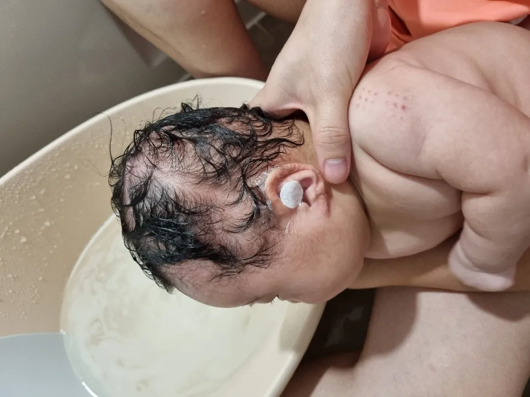 아기 두상 단두증 사두증 걱정하시는 분 계시나요?