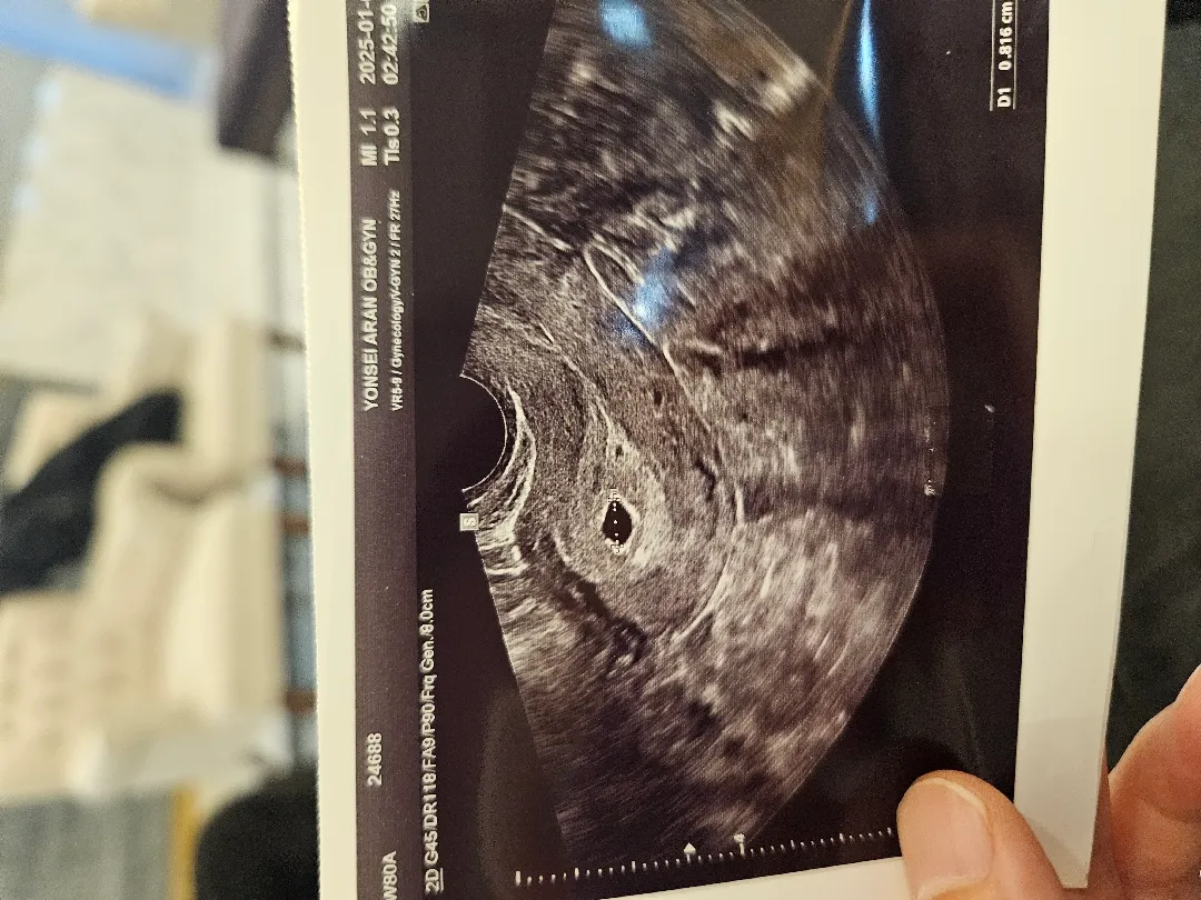 아기집 보고 왔어요! 4주 6일이요