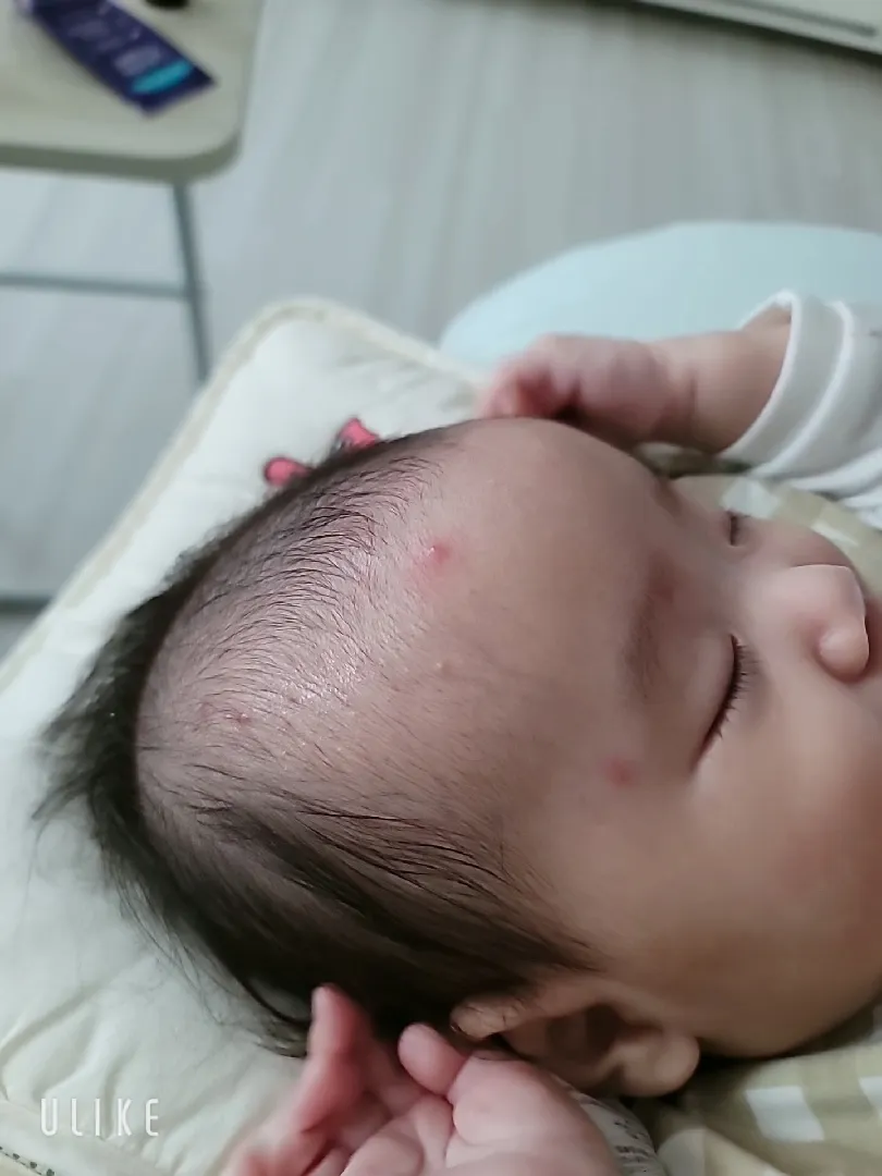 이 피부 증상 뭔지 아시는분..?