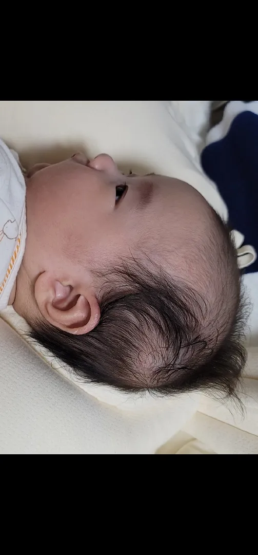아기 두상 존 봐주세요 단두증인가요?