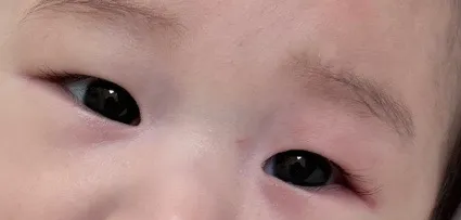 아기 피부좀 주세요ㅠㅠ