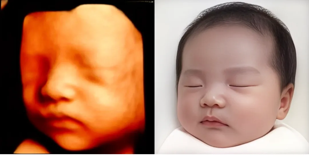 입체초음파 보고왔어용~!