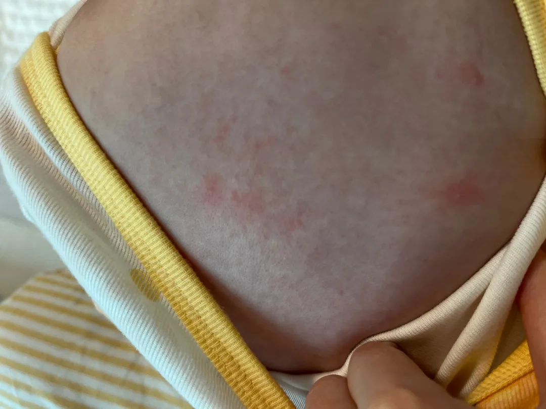 피부 이게 뭘까요?ㅜㅜ