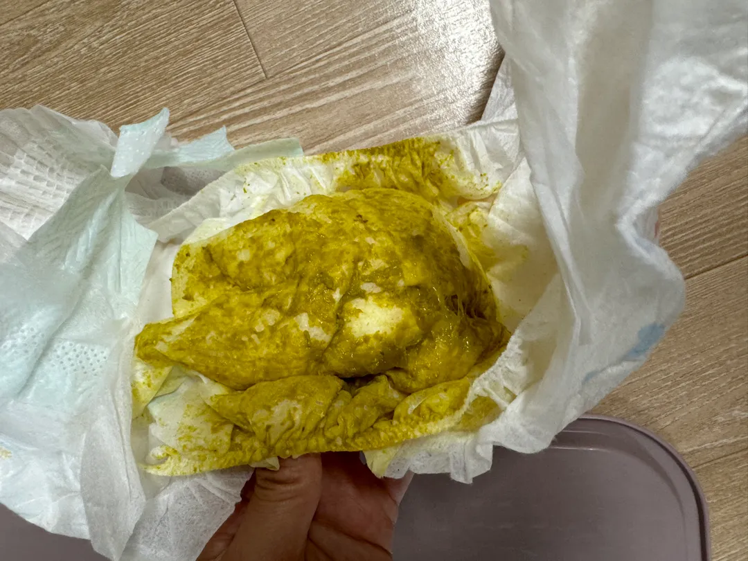 11개월아기 변좀 봐주세요..
