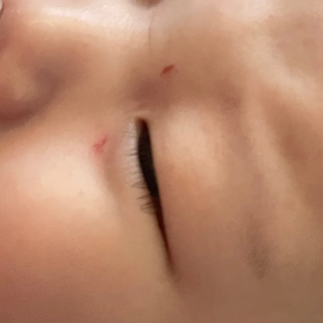 얼굴에 상처 ㅜㅜ 엄마마음도 상처 ㅜㅜ
