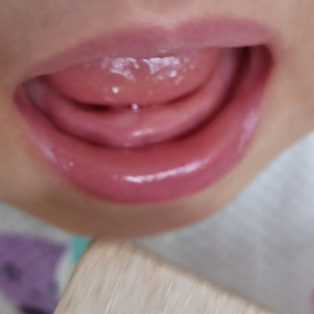 잇몸에 이가 하얗게 올라오기 시작하면 얼마만에 나오나요?