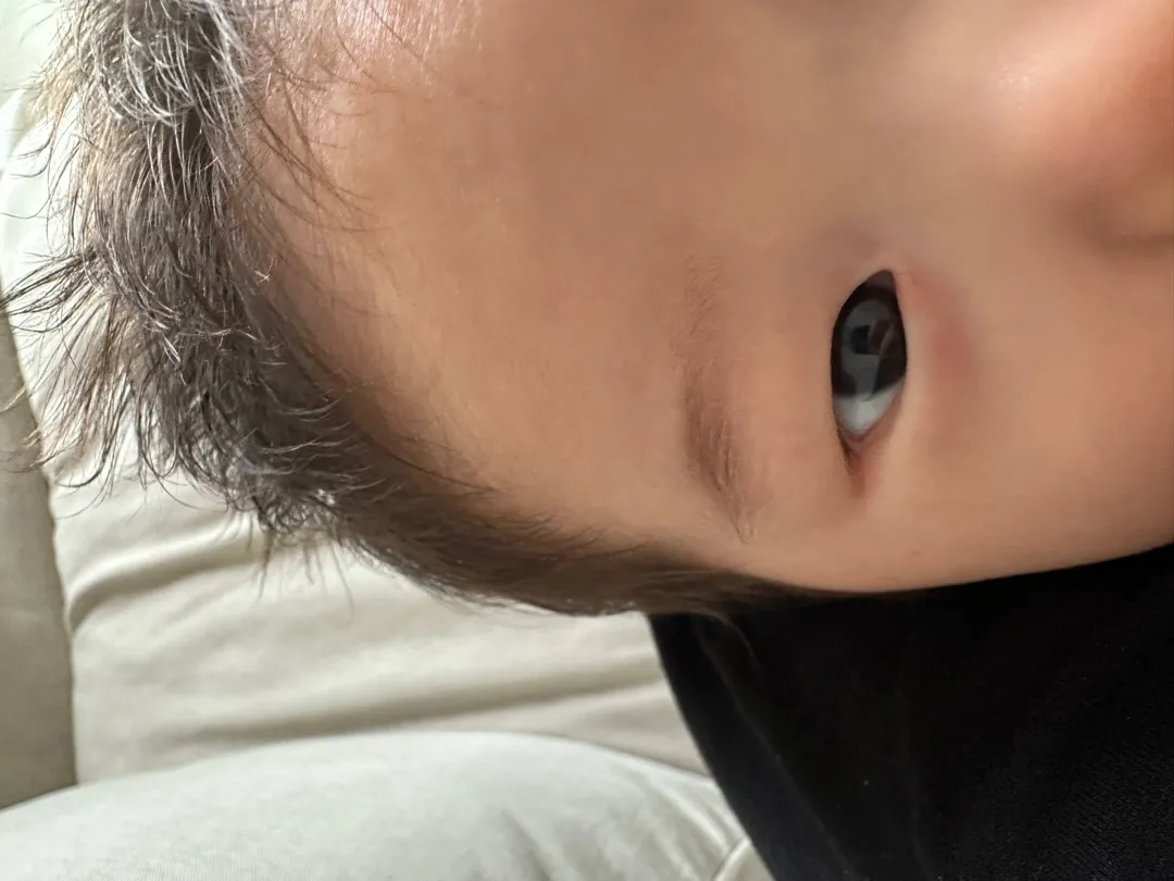 아기 한쪽눈이 살짝 붓고 빨개졌어요 ㅠㅠ (사진 있어요)