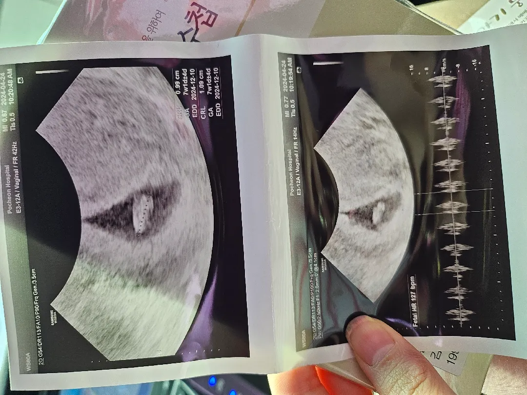 연년생..⁉️