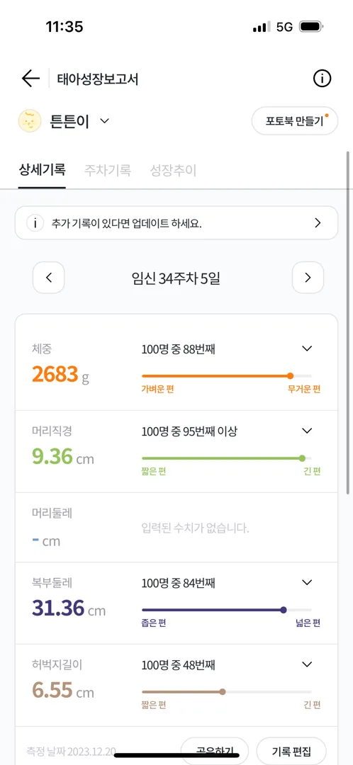 제왕 날짜 잡고 왔어요 아기 너무 큰가요?