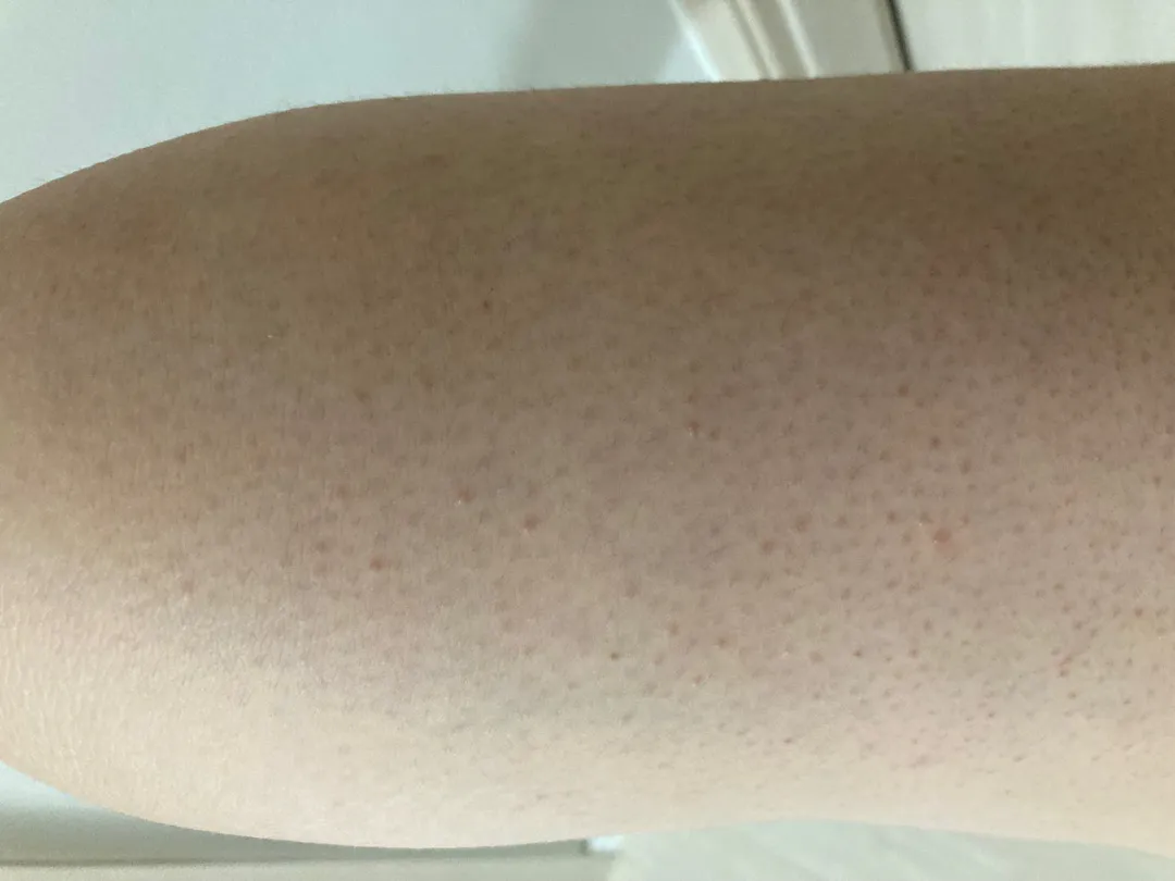 피부좀 봐주세요!!!ㅠㅠㅠ(엄마피부요ㅋㅋ)