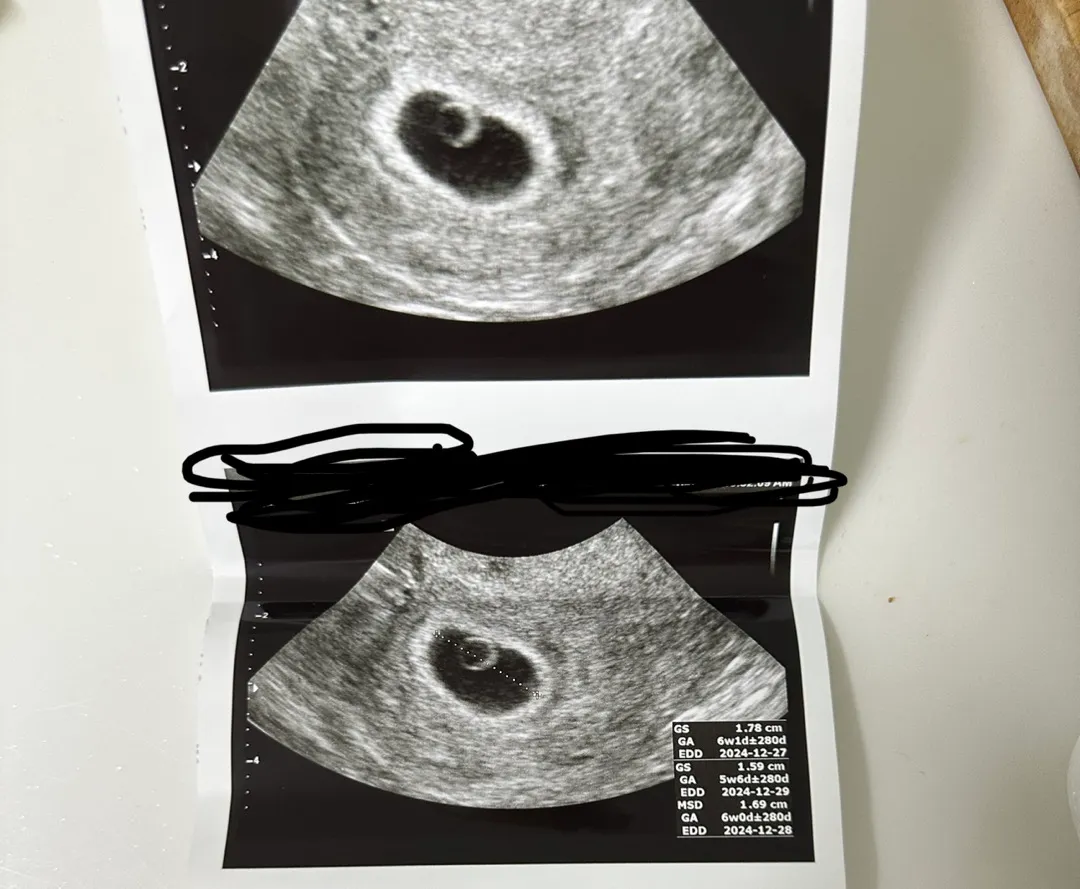 초음파상으로 6주1일 아기가 안보여요