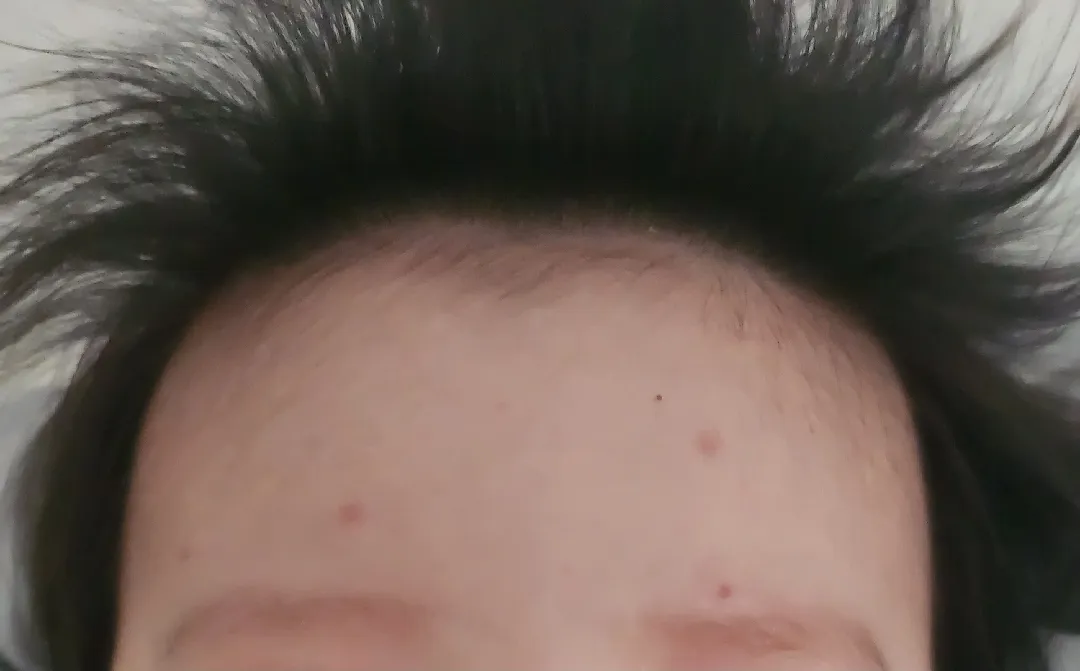 반점