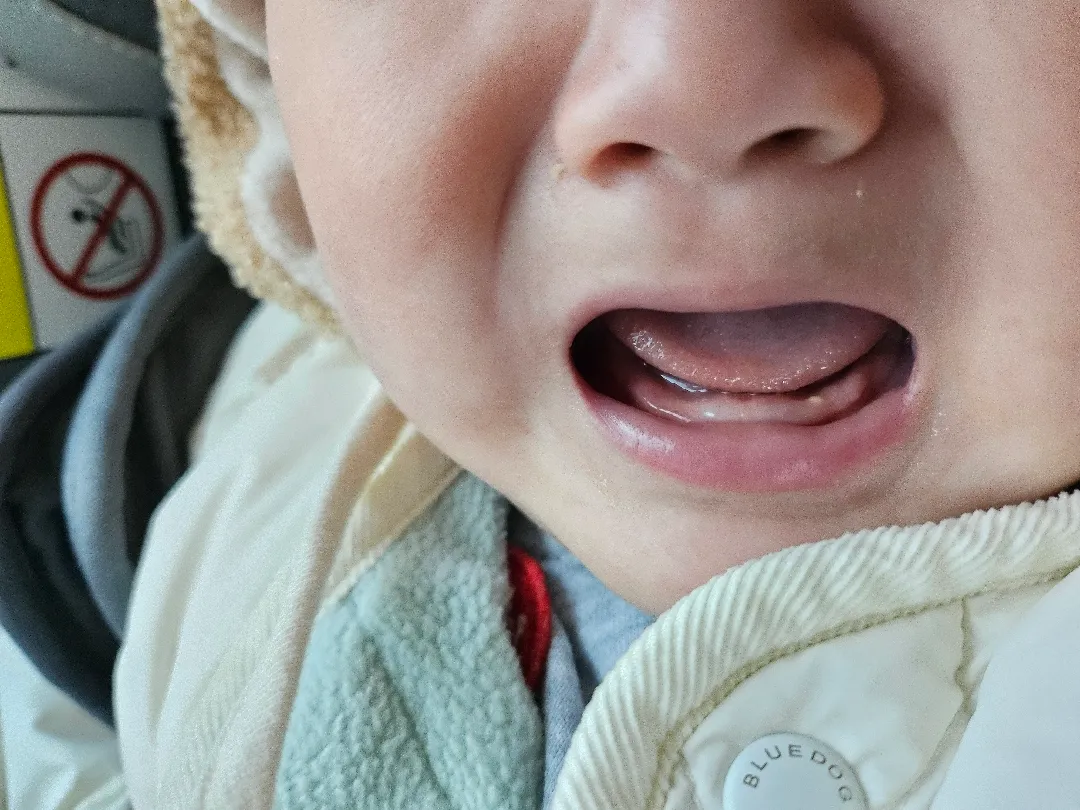 드디어 첫니가 나오려나봐요!!!! 치약추천도 부탁드려요♡