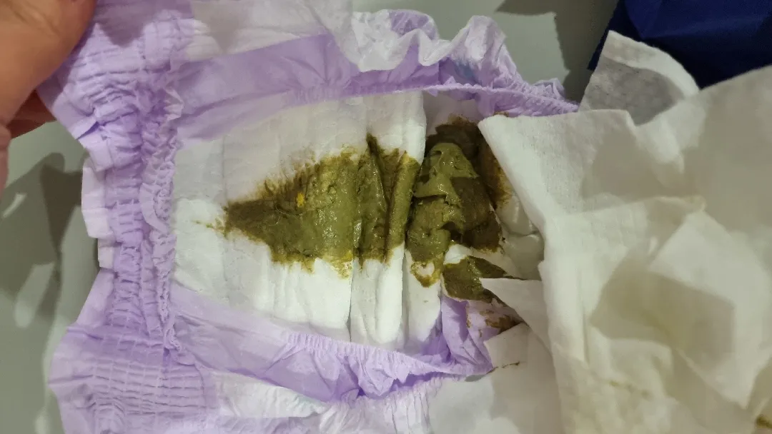 녹변인데 설사인지 일반 대변인지 궁금해요(사진 주의)