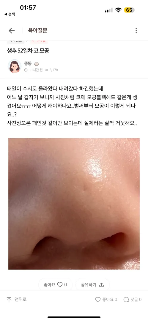 52일차 코 모공