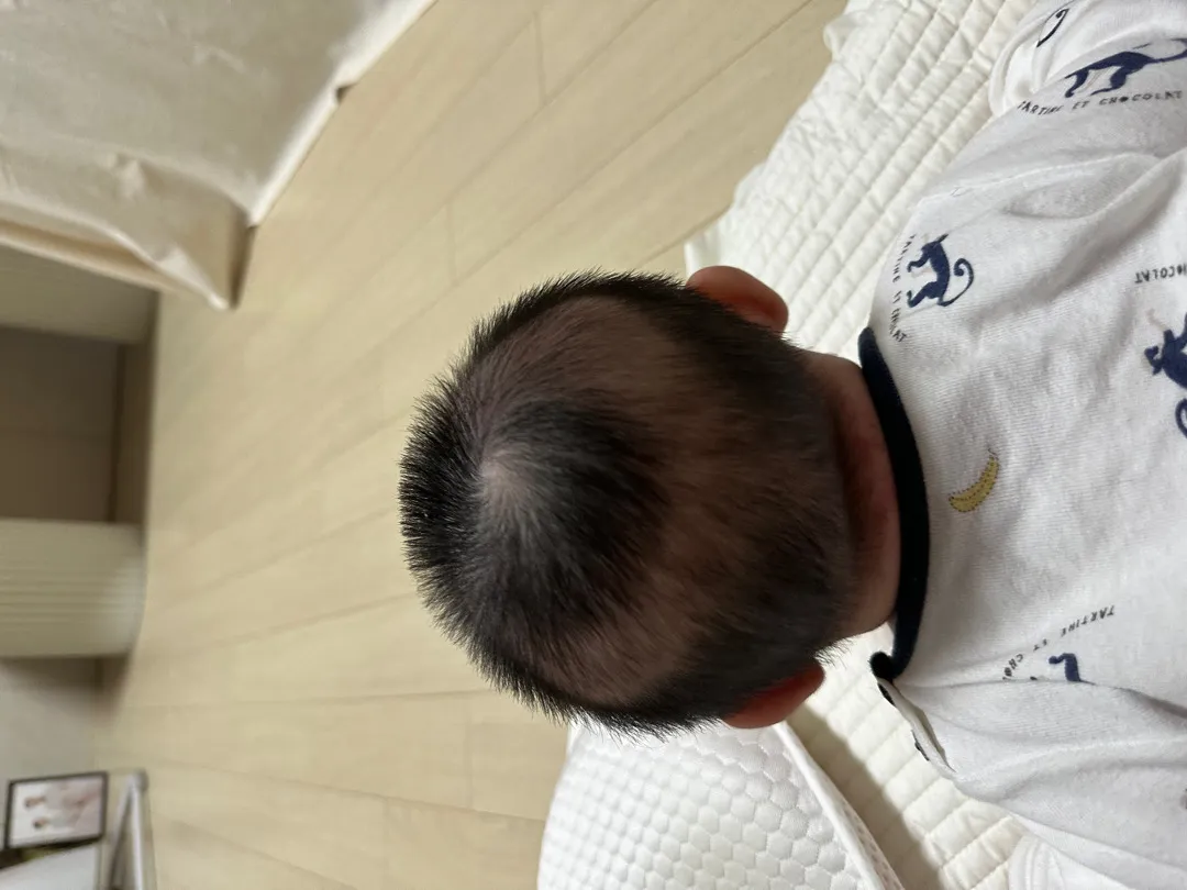 사두증 맞을까요??